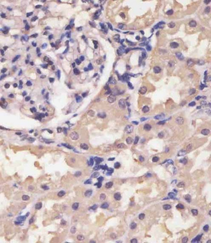 HIF1A Antibody Peptide Affinity Purified Rabbit Polyclonal Antibody