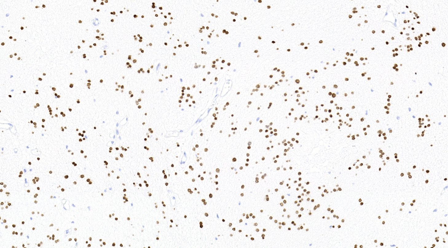14 - H3K27M antibody AD80006
