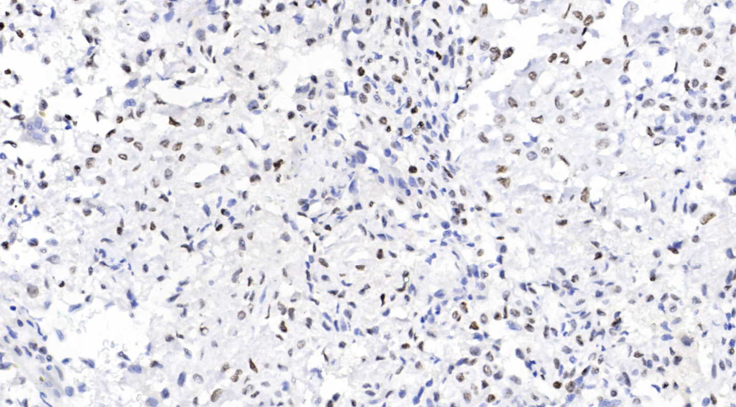 14 - H3K36M antibody AD80012