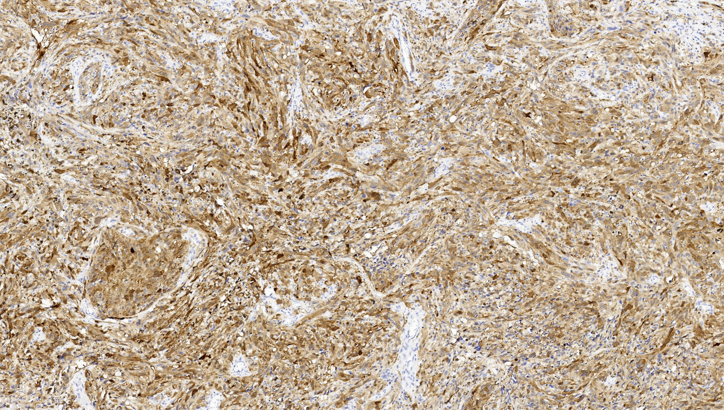 14 - NY-ESO-1 antibody AD80013