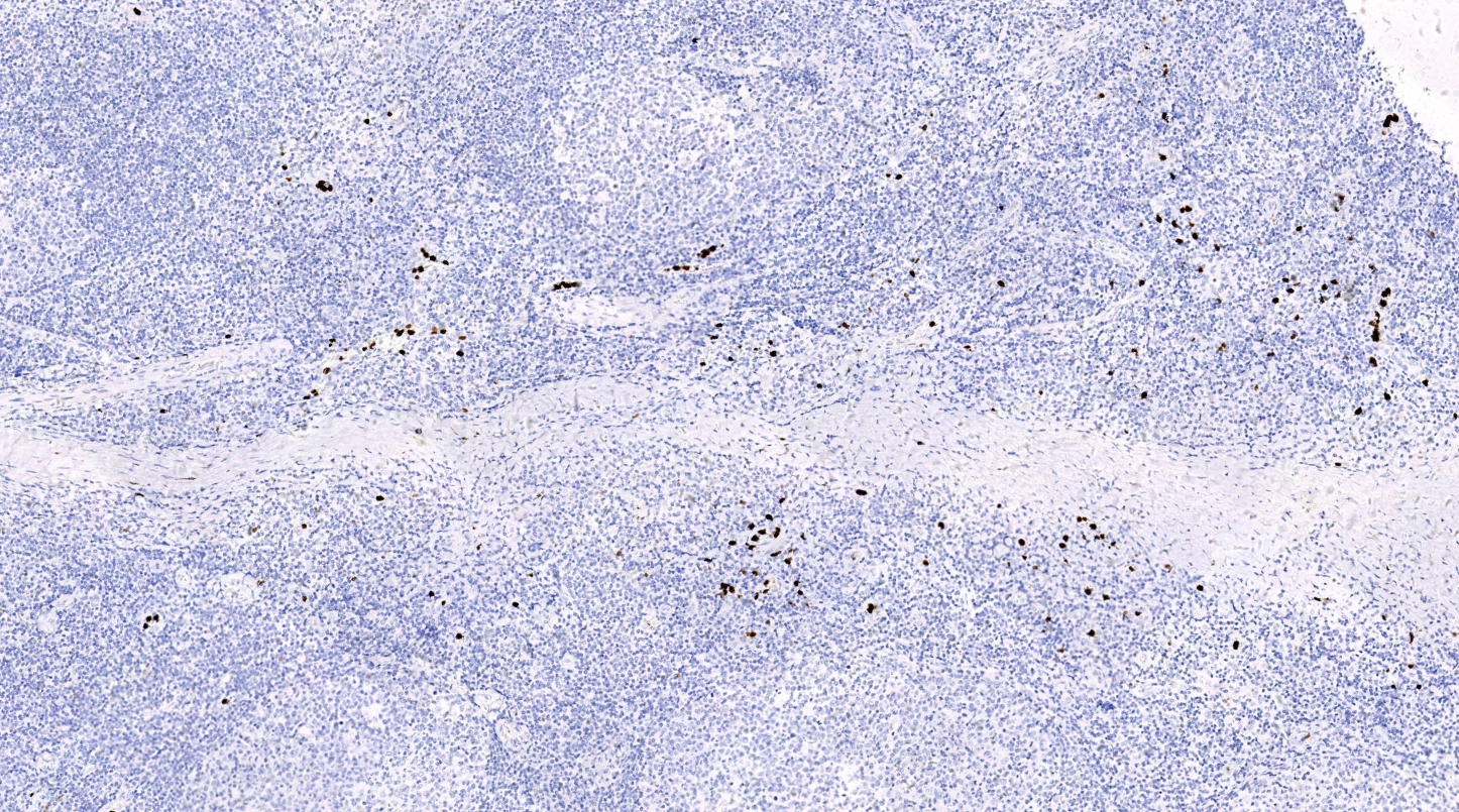 14 - MHA antibody AD80016