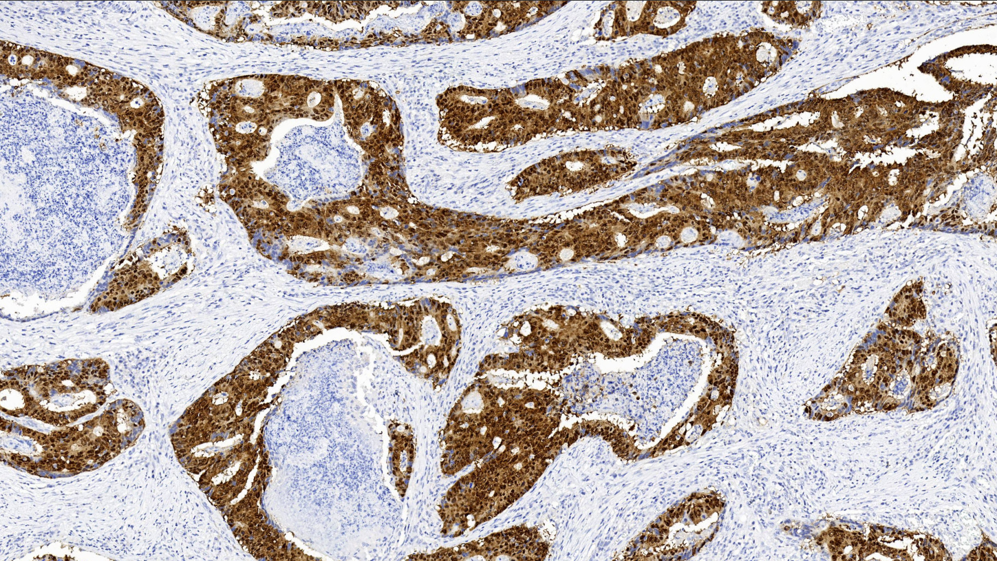 14 - SOX-9 antibody AD80022