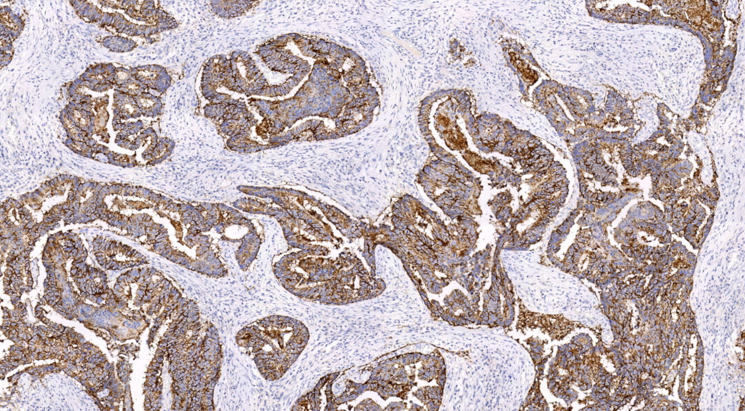 14 - Claudin-1 antibody AD80027