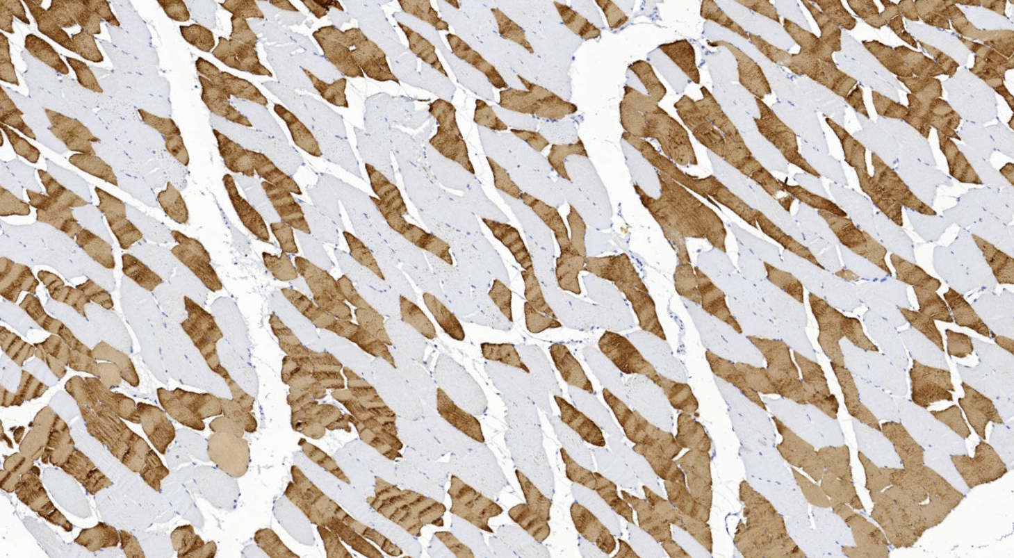 14 - Skeletal Myosin antibody AD80034