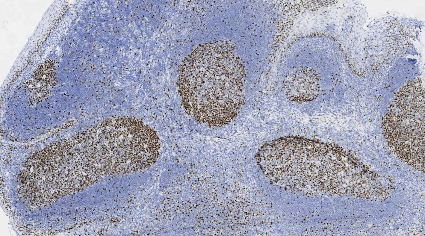 14 - MCM2 antibody AD80068