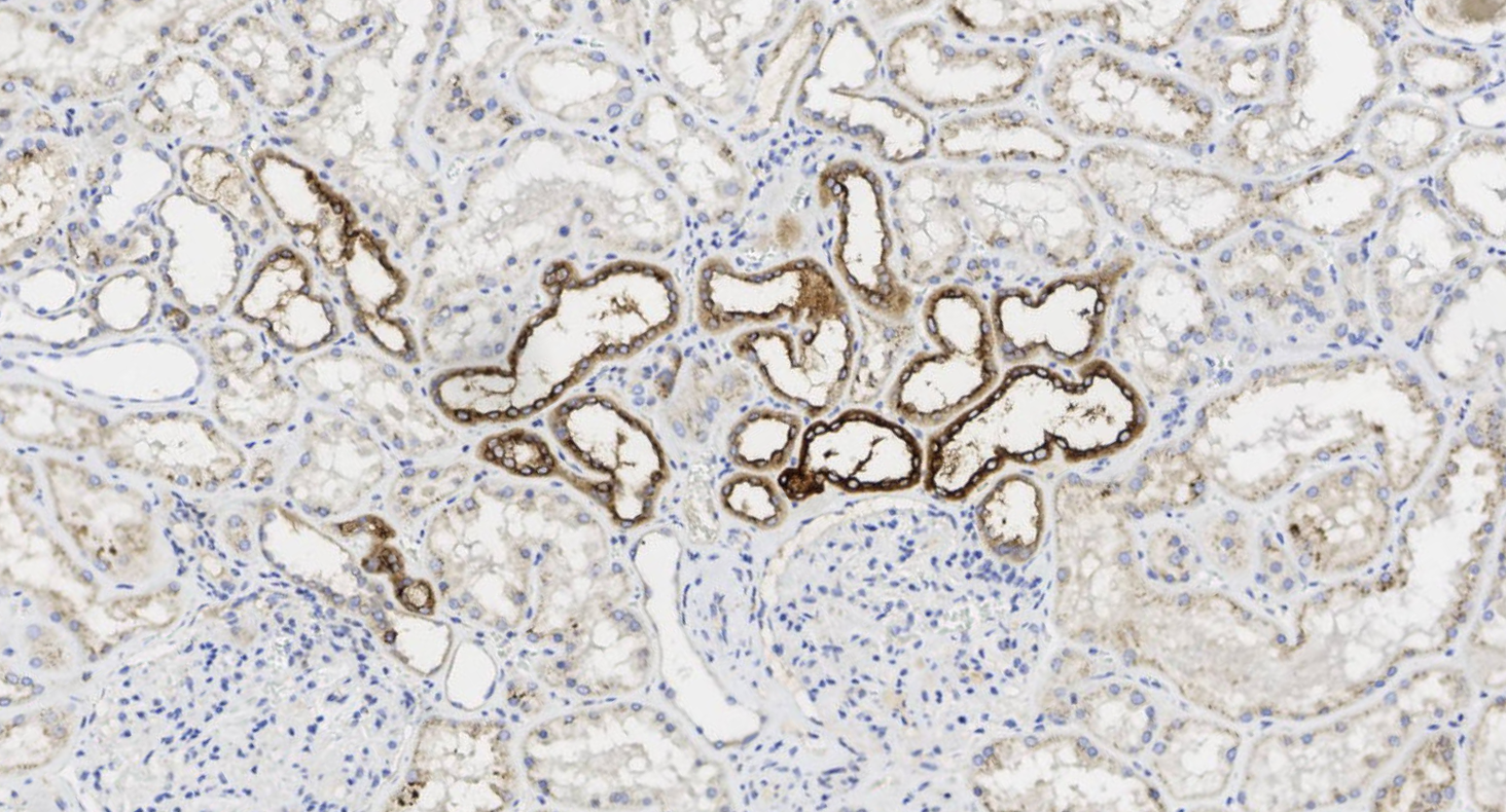 14 - Osteopontin antibody AD80071