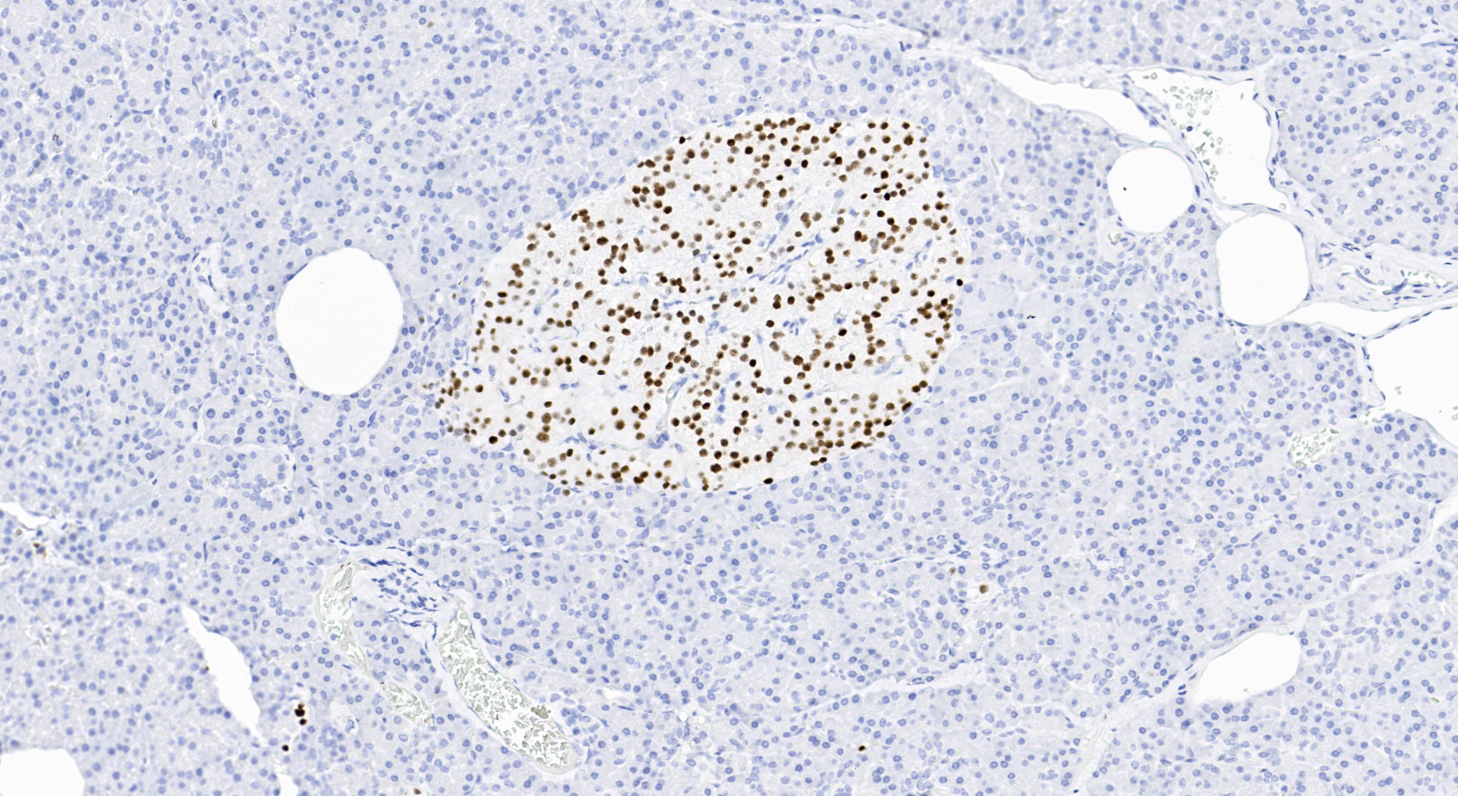 14 - INSM1 antibody AD80598