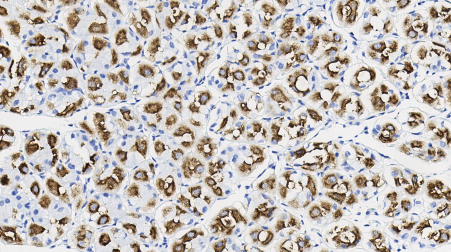 14 - H+/K+ATPase beta antibody AD80596