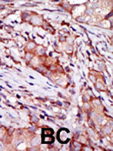 14 - KIP2 Antibody (N-term) AP8158a