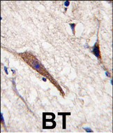 14 - PAK5 Antibody AP7930a