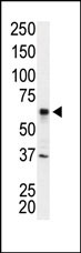 1 - IRAK2 Antibody (N-term) AP7803a