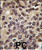 14 - PKN beta Antibody (C-term) AP7935a