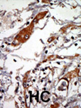 14 - WNK3 (PRKWNK3) Antibody (N-term) AP7054a