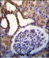 14 - WNK3 (PRKWNK3) Antibody (C-term) AP7054b