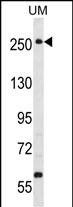 1 - WNK3 (PRKWNK3) Antibody (C-term) AP7054b