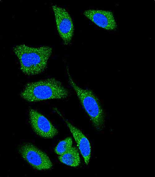 3 - DAPK1 Antibody (C-term) AP7217b
