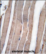14 - DAPK1 Antibody (C-term) AP7217b