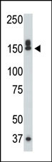1 - DAPK1 Antibody (C-term) AP7217b