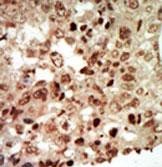 14 - MAPK11 Antibody (Center) AP7223C