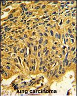 14 - CDK2 Antibody (C-term) AP7518B
