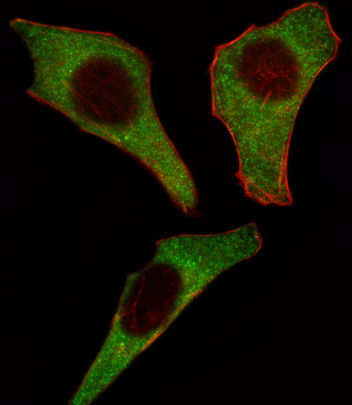 3 - CDK4 Antibody (C-term) AP7520B
