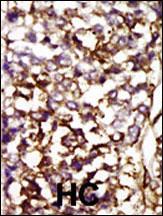 14 - CDK4 Antibody (C-term) AP7520B
