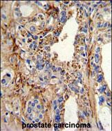 14 - CDK4 Antibody (C-term) AP7520B