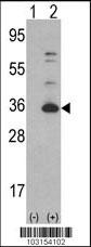 1 - CDK4 Antibody (C-term) AP7520B