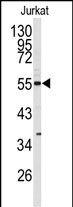 1 - CDK8 Antibody (N-term) AP7524a