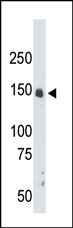 1 - CrkRS (CRK7) Antibody (N-term) AP7533A