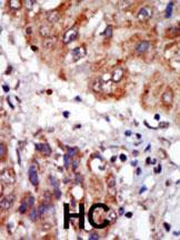 14 - LIM Kinase 1 (LIMK1) Antibody (N-term) AP7813A