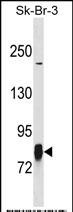 1 - LIM Kinase 1 (LIMK1) Antibody (N-term) AP7813A