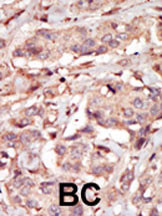 14 - PERK Antibody (C-term) AP8054b