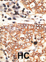 14 - NRG2 Antibody (C-term) AP6223a