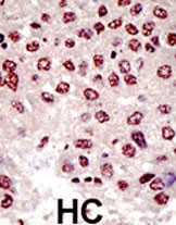 14 - UBE4B Antibody (N-term) AP2111a
