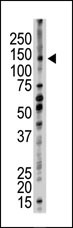 1 - UBE4B Antibody (N-term) AP2111a