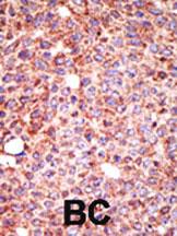 14 - MGAT3 Antibody (N-term) AP2411A