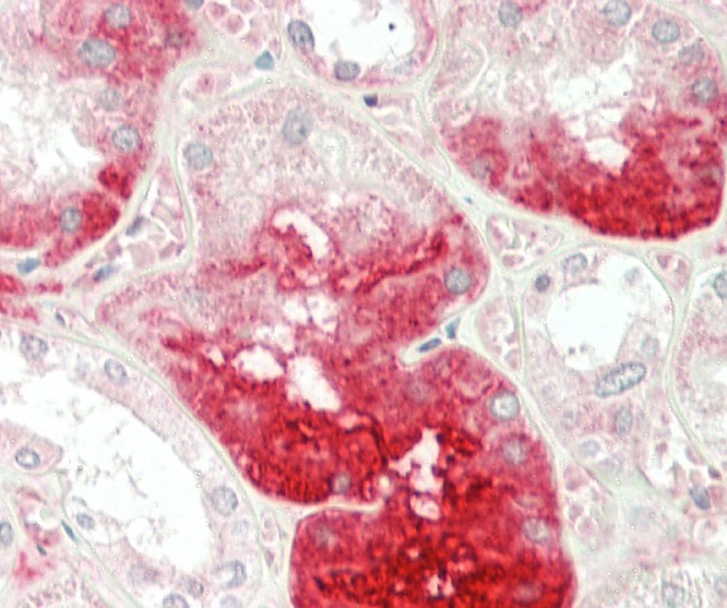 14 - MGAT3 Antibody (N-term) AP2411A
