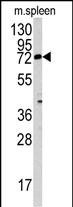 1 - MGAT3 Antibody (N-term) AP2411A