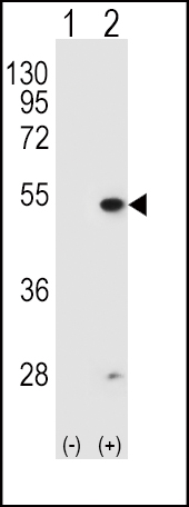 1 - FDFT1 Antibody (N-term) AP2417A