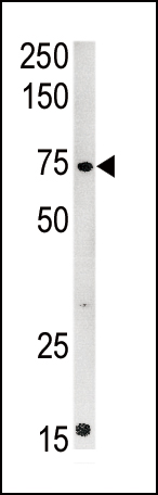 1 - CPT2 Antibody (C-term) AP2531b
