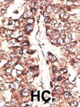 14 - MAGEA11 Antibody (N-term) AP6161a