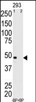 1 - MAGEA11 Antibody (N-term) AP6161a
