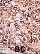 14 - MAGEA2 Antibody (N-term) AP6164a
