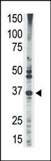 1 - MAGEA2 Antibody (N-term) AP6164a