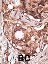 14 - MAGEB2 Antibody (N-term) AP6172a