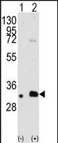1 - MAGEB2 Antibody (N-term) AP6172a