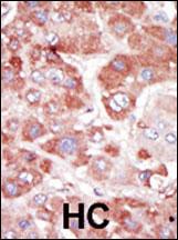 14 - GRK7 Antibody (C-term) AP7731b