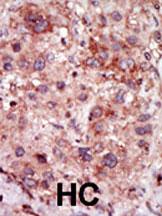 14 - GAK Antibody (N-term) AP8061a