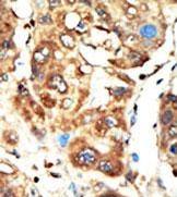 14 - BAIAP1 (MAGI1)Antibody (C-term) AP8173A